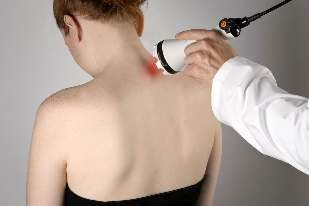 fizioterapijski tretman cervikalne osteohondroze