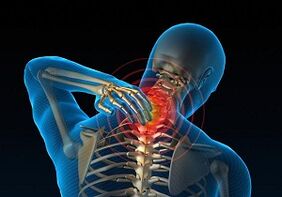 Zašto se razvija i kako se očituje cervikalna osteohondroza